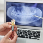 Longevity of Dental Implants: Causes and Fixes for Damages