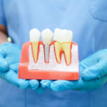 Understanding Dental Implants: Procedures, Benefits, and Innovations for a New Smile
